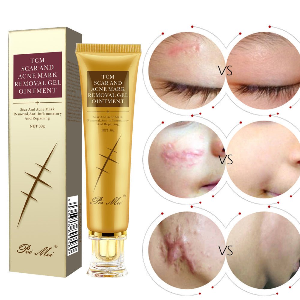 Light Scar Cream Scar Fine Grain Desalination Skin Care Products - The Sunflower Store Co