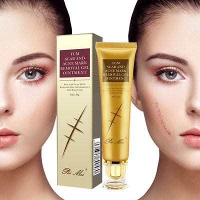 Light Scar Cream Scar Fine Grain Desalination Skin Care Products - The Sunflower Store Co